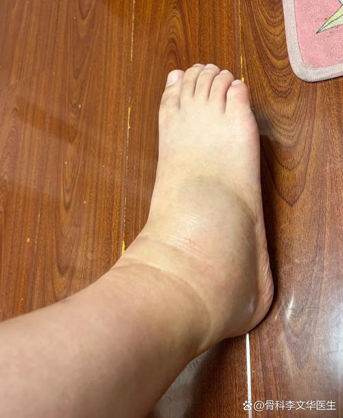 队记：迪恩韦德热身时疑似扭伤了脚踝目前不清楚伤势程度